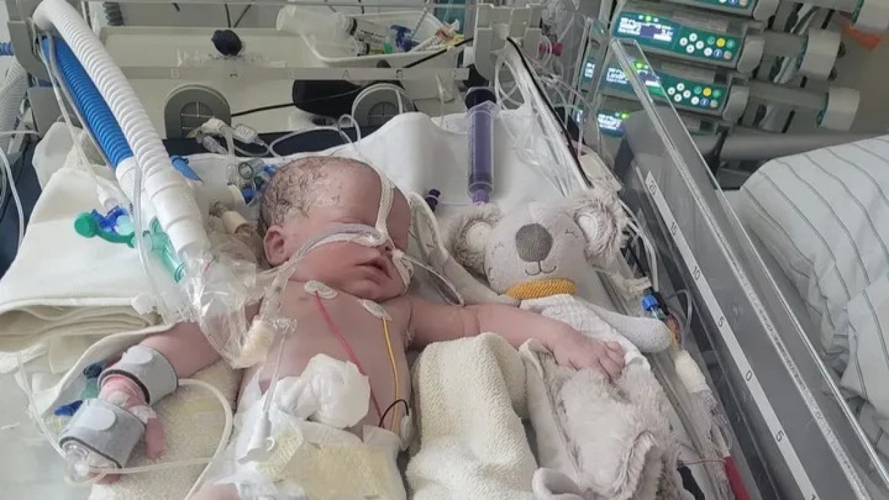 Mia ist mit einer Zwerchfellharnie auf die Welt gekommen und aktuell auf eine Beatmungsmaschine angewiesen. von privat