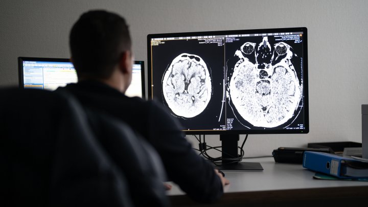 Das Institut für Radiologie und Nuklearmedizin am St.-Martinus-Hospital in Olpe ist in die...