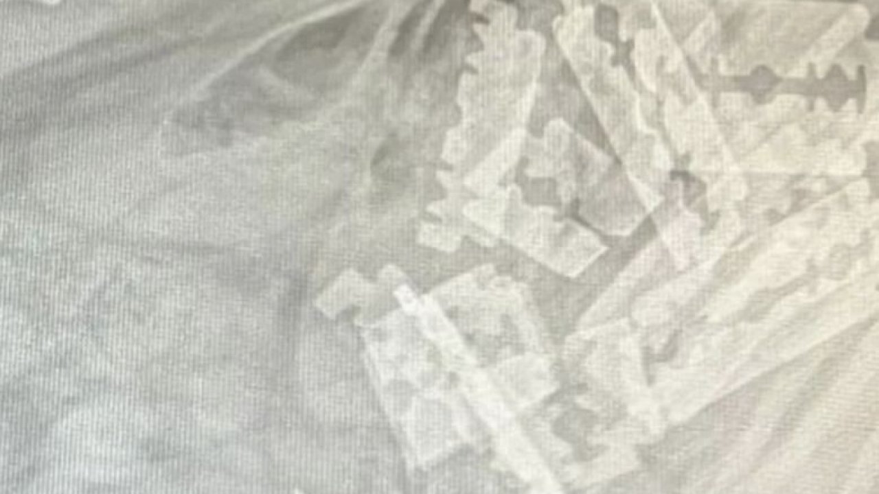 Auf einem Röntgenbild sind zahlreiche Rasierklingen zu sehen, die ein Hund geschluckt hat. von Polizei MK